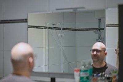 Vroege kaalheid heeft een oorzaak die niemand verwacht